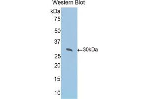 Western blot analysis of the recombinant protein. (Peroxiredoxin 4 抗体  (AA 14-258))
