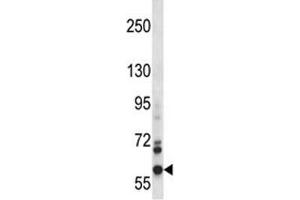 NOX5 antibody western blot analysis in CEM lysate. (NOX5 抗体  (AA 680-709))