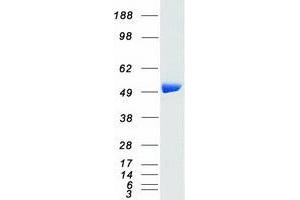 Western Blotting (WB) image for C-Src tyrosine Kinase (CSK) (Transcript Variant 1) (Active) protein (Myc-DYKDDDDK Tag) (ABIN2712578)