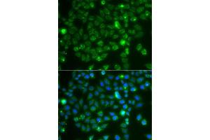 Immunofluorescence (IF) image for anti-RAC1 (AA 1-192) antibody (ABIN6146616)