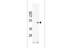 Western blot analysis of CKB (arrow) using rabbit polyclonal CKB- (ABIN391074 and ABIN2841221). (CKB 抗体  (C-Term))