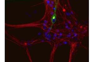 Immunostaining of cultured newborn rat neurons and glia showing peripherin in green and neurofilament L in red. (Peripherin 抗体)