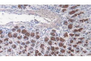 Detection of TNC in Mouse Stomach Tissue using Polyclonal Antibody to Tenascin C (TNC)