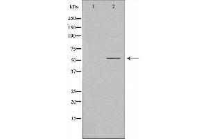 Western blot analysis of extracts from HuvEc cells, using RORG antibody. (RORC 抗体  (Internal Region))