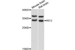 Western blot analysis of extracts of various cell lines, using RIT2 antibody (ABIN6292260) at 1:3000 dilution. (RIT2 抗体)