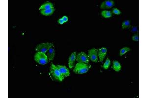 Immunofluorescent analysis of HepG2 cells using ABIN7170654 at dilution of 1:100 and Alexa Fluor 488-congugated AffiniPure Goat Anti-Rabbit IgG(H+L) (SPRY2 抗体  (AA 2-97))