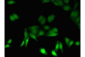 Immunofluorescent analysis of HepG2 cells using ABIN7164982 at dilution of 1:100 and Alexa Fluor 488-congugated AffiniPure Goat Anti-Rabbit IgG(H+L) (PSMB5 抗体  (AA 106-188))