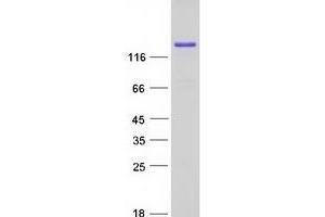 Western Blotting (WB) image for FK506 Binding Protein 15, 133kDa (FKBP15) protein (Myc-DYKDDDDK Tag) (ABIN2721204)