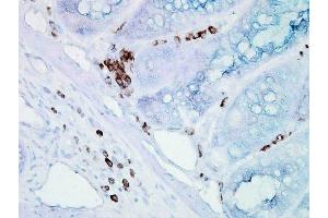 Immunohistochemistry analysis using Mouse Anti-Hsp70 Monoclonal Antibody, Clone BB70 . (HSP70/HSC70 抗体  (FITC))