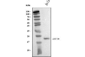 Western blot analysis of ASF1B using anti-ASF1B antibody (ABIN7599074).