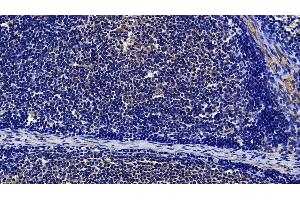 Immunohistochemistry (IHC) image for anti-Toll-Like Receptor 3 (TLR3) (AA 404-532) antibody (ABIN7434491)