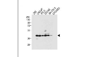 All lanes : Anti-STRA8 Antibody (C-term) at 1:2000 dilution Lane 1: 293 whole cell lysate Lane 2: LNCaP whole cell lysate Lane 3: PC-3 whole cell lysate Lane 4: D whole cell lysate Lane 5: SK-OV-3 whole cell lysate Lane 6: OVCAR3 whole cell lysate Lysates/proteins at 20 μg per lane. (STRA8 抗体  (C-Term))