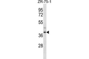 Western Blotting (WB) image for anti-Formyl Peptide Receptor 3 (FPR3) antibody (ABIN2997055) (FPR3 抗体)
