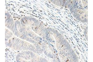 Image no. 1 for anti-Chemokine (C-X-C Motif) Ligand 5 (CXCL5) antibody (ABIN465535) (CXCL5 抗体)