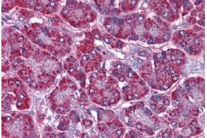 Human Pancreas: Formalin-Fixed, Paraffin-Embedded (FFPE) (SORBS1 抗体  (AA 300-313))