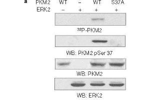 Western blot analysis of in vitro kinase assays carried out with puried active ERK2, wild-type (WT) PKM2 and PKM2 S37A mutant using PKM2(phospho-Ser37)Antibody. (PKM 抗体  (pSer37))