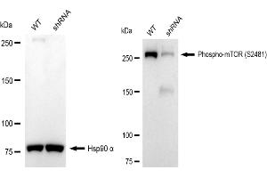 Western blotting analysis using Phospho-mTOR (S) antibody (ABIN7799349). (Recombinant MTOR 抗体  (pSer2481))