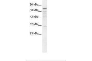 Image no. 1 for anti-tRNA Methyltransferase 1 (TRMT1) (AA 418-467) antibody (ABIN202857) (TRMT1 抗体  (AA 418-467))