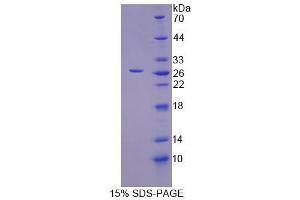 Image no. 1 for Inosine Triphosphatase (ITPA) (AA 3-180) protein (S tag,His tag) (ABIN6238561)
