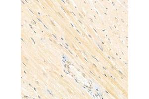 Immunohistochemistry of paraffin embedded rat heart using Arhgap17 (ABIN7075416) at dilution of 1: 700 (400x lens) (ARHGAP17 抗体)