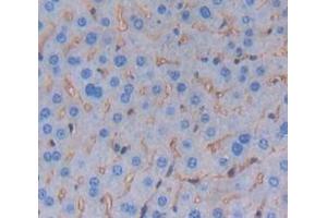 IHC-P analysis of Mouse Tissue, with DAB staining. (TREM1 抗体  (AA 21-230))