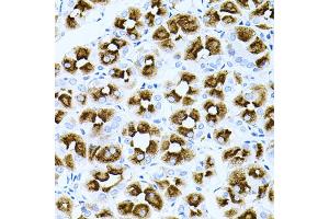 Immunohistochemistry of paraffin-embedded human stomach using DLK1 antibody (ABIN2562237) at dilution of 1:100 (40x lens).