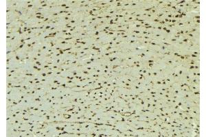 ABIN6277622 at 1/100 staining Mouse muscle tissue by IHC-P.
