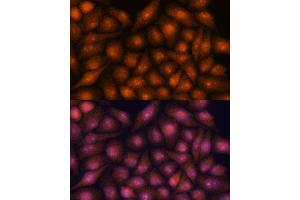 Immunofluorescence analysis of HeLa cells using DDX31 antibody (ABIN7266695) at dilution of 1:100. (DDX31 抗体  (AA 652-851))