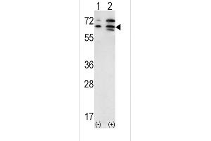 Western blot analysis of ACVR2A (arrow) using rabbit polyclonal ACVR2A Antibody (N-term) (ABIN391160 and ABIN2841268). (ACVR2A 抗体  (N-Term))