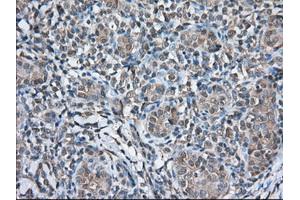 Immunohistochemical staining of paraffin-embedded Human Kidney tissue using anti-TBXAS1 mouse monoclonal antibody. (TBXAS1 抗体)