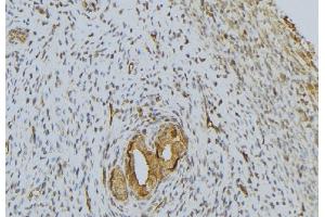 ABIN6276642 at 1/100 staining Human uterus tissue by IHC-P. (PRSS1 抗体  (Internal Region))