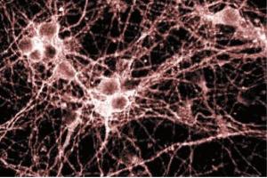 Immunofluorescence staining of cortical neurons. (Metabotropic Glutamate Receptor 1 抗体  (AA 1042-1160))