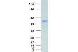 Validation with Western Blot