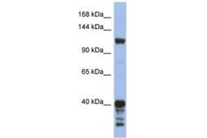 Image no. 1 for anti-Signal-Induced Proliferation-Associated 1 (SIPA1) (AA 863-912) antibody (ABIN6744322) (SIPA1 抗体  (AA 863-912))