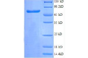SDS-PAGE (SDS) image for Tripartite Motif Containing 28 (TRIM28) (AA 22-291), (partial) protein (GST tag) (ABIN7479619)