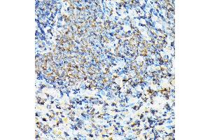 Immunohistochemistry of paraffin-embedded mouse spleen using CORO1A Rabbit pAb (ABIN6133495, ABIN6138903, ABIN6138904 and ABIN6224969) at dilution of 1:100 (40x lens). (Coronin 1a 抗体  (AA 362-461))