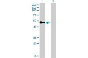 Western Blot analysis of TNFRSF19 expression in transfected 293T cell line by TNFRSF19 monoclonal antibody (M01), clone 2G4. (TNFRSF19 抗体  (AA 30-119))