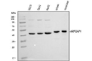 Western blot analysis of ARFGAP1 using anti-ARFGAP1 antibody (ABIN4886474). (ARFGAP1 抗体  (AA 1-183))