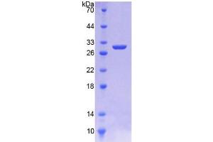 SDS-PAGE analysis of Rat HMGCR Protein. (HMGCR 蛋白)