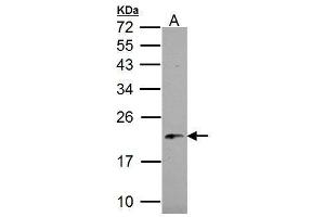Western Blotting (WB) image for anti-NADH Dehydrogenase (Ubiquinone) 1 beta Subcomplex, 5, 16kDa (NDUFB5) (C-Term) antibody (ABIN2856830)