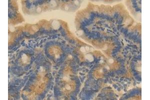 Detection of ESAM in Mouse Small intestine Tissue using Polyclonal Antibody to Endothelial Cell Adhesion Molecule (ESAM) (ESAM 抗体  (AA 29-248))