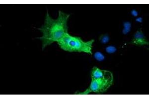 Anti-CALCOCO2 mouse monoclonal antibody (ABIN2453988) immunofluorescent staining of COS7 cells transiently transfected by pCMV6-ENTRY CALCOCO2 (RC203843). (CALCOCO2 抗体)
