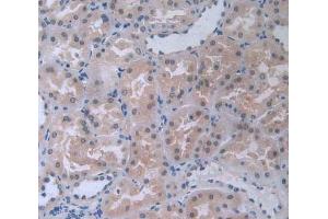 IHC-P analysis of kidney tissue, with DAB staining. (COL4a5 抗体  (AA 1461-1685))
