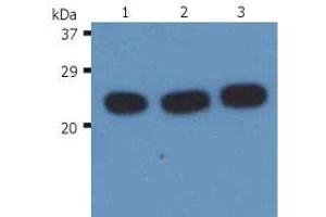 Western Blotting analysis (reducing conditions) of H-Ras in whole cell lysate using anti-H-Ras (H-RAS-03). (HRAS 抗体)