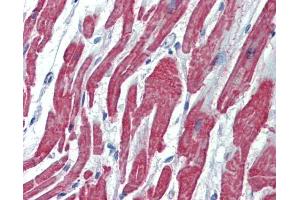 Immunohistochemistry (IHC) image for anti-Activin A Receptor Type II-Like 1 (ACVRL1) (C-Term) antibody (ABIN2857028)