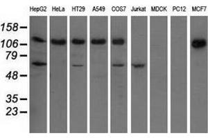 Western blot analysis of extracts (35 µg) from 9 different cell lines by using anti-IGF2BP2 monoclonal antibody. (IGF2BP2 抗体)