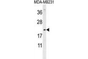Western blot analysis in MDA-MB231 cell line lysates (35ug/lane) using DMRTC1 Antibody (N-term). (DMRTC1 抗体  (N-Term))