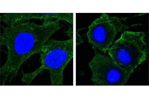 Confocal immunofluorescence analysis of Hela (left) and HepG2 (right) cells using KDR mouse mAb (green).