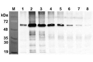 Immunoprecipitation of recombinant human FTO proteins using anti-FTO (human), mAb (AG103)  at different concentrations. (FTO 抗体)