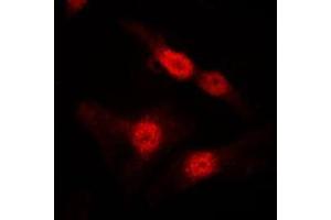 Immunofluorescent analysis of DGK alpha staining in MDCK cells. (DGKA 抗体  (Center))
